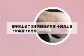 孩子背上長了很多類似癬的東西 小孩身上背上長癬是什么意思
