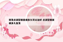 初發(fā)點(diǎn)滴型銀屑病多久可以治好 點(diǎn)滴型銀屑病多久復(fù)發(fā)