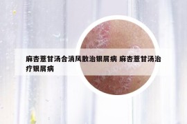 麻杏薏甘湯合消風(fēng)散治銀屑病 麻杏薏甘湯治療銀屑病
