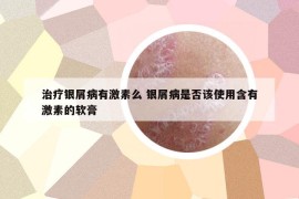 治療銀屑病有激素么 銀屑病是否該使用含有激素的軟膏