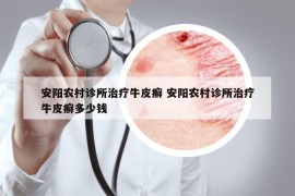 安陽(yáng)農(nóng)村診所治療牛皮癬 安陽(yáng)農(nóng)村診所治療牛皮癬多少錢(qián)