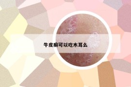 牛皮癬可以吃木耳么