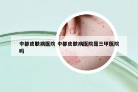 中都皮膚病醫(yī)院 中都皮膚病醫(yī)院是三甲醫(yī)院嗎
