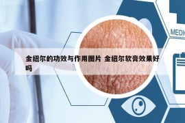 金紐爾的功效與作用圖片 金紐爾軟膏效果好嗎