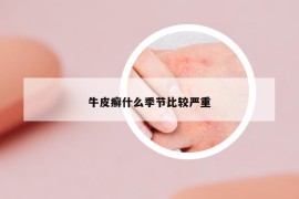 牛皮癬什么季節(jié)比較嚴(yán)重