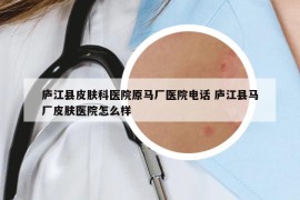 廬江縣皮膚科醫(yī)院原馬廠醫(yī)院電話(huà) 廬江縣馬廠皮膚醫(yī)院怎么樣