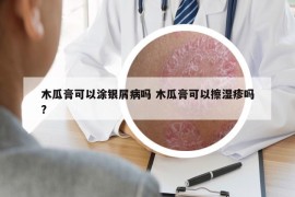木瓜膏可以涂銀屑病嗎 木瓜膏可以擦濕疹嗎?