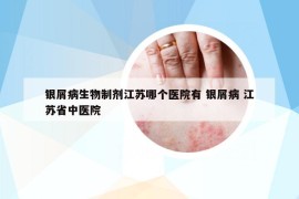 銀屑病生物制劑江蘇哪個醫(yī)院有 銀屑病 江蘇省中醫(yī)院