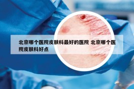 北京哪個(gè)醫(yī)院皮膚科最好的醫(yī)院 北京哪個(gè)醫(yī)院皮膚科好點(diǎn)