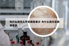 為什么南方人牛皮癬患者少 為什么南方皮膚病很多