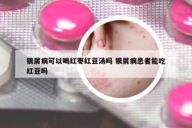 銀屑病可以喝紅棗紅豆湯嗎 銀屑病患者能吃紅豆嗎