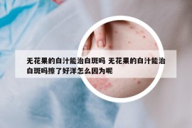無花果的白汁能治白斑嗎 無花果的白汁能治白斑嗎擦了好洋怎么因為呢
