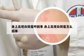 身上出現(xiàn)白斑是咋回事 身上出現(xiàn)白斑是怎么回事