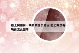 臉上突然有一塊白的什么原因 臉上突然有一塊白怎么回事