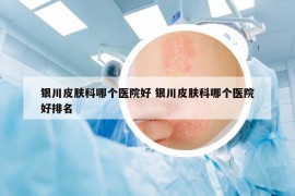 銀川皮膚科哪個醫(yī)院好 銀川皮膚科哪個醫(yī)院好排名