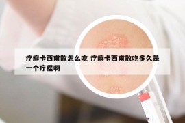 療癬卡西甫散怎么吃 療癬卡西甫散吃多久是一個(gè)療程啊