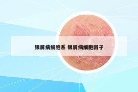 銀屑病細胞系 銀屑病細胞因子
