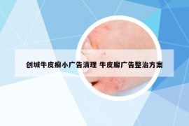 創(chuàng)城牛皮癬小廣告清理 牛皮廨廣告整治方案
