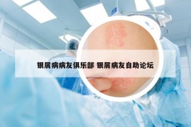 銀屑病病友俱樂部 銀屑病友自助論壇