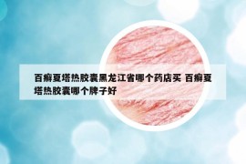 百癬夏塔熱膠囊黑龍江省哪個藥店買 百癬夏塔熱膠囊哪個牌子好