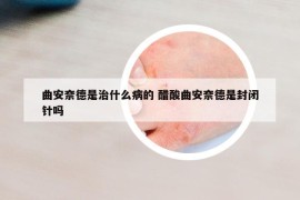 曲安奈德是治什么病的 醋酸曲安奈德是封閉針嗎