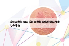 成都四道街皮膚 成都四道街皮膚科研究所坐幾號地鐵