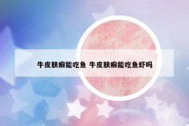 牛皮膚癬能吃魚 牛皮膚癬能吃魚蝦嗎