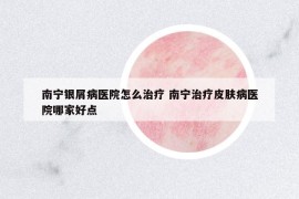 南寧銀屑病醫(yī)院怎么治療 南寧治療皮膚病醫(yī)院哪家好點