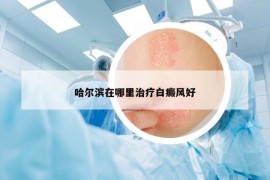 哈爾濱在哪里治療白癜風(fēng)好