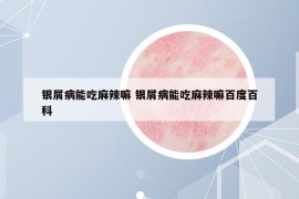 銀屑病能吃麻辣嘛 銀屑病能吃麻辣嘛百度百科