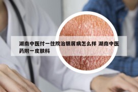 湖南中醫(yī)付一住院治銀屑病怎么樣 湖南中醫(yī)藥附一皮膚科