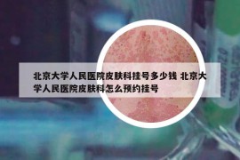 北京大學人民醫(yī)院皮膚科掛號多少錢 北京大學人民醫(yī)院皮膚科怎么預約掛號
