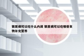 銀屑病可以吃什么內(nèi)調(diào) 銀屑病可以吃哪些食物補(bǔ)充營(yíng)養(yǎng)