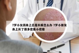 7歲小女孩身上總是長癬怎么辦 7歲小朋友身上長了很多密集小疙瘩