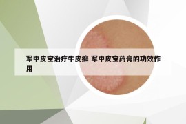 軍中皮寶治療牛皮癬 軍中皮寶藥膏的功效作用