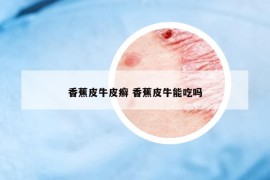 香蕉皮牛皮癬 香蕉皮牛能吃嗎