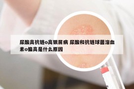 尿酸高抗鏈o高銀屑病 尿酸和抗鏈球菌溶血素o偏高是什么原因