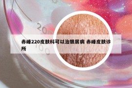 赤峰220皮膚科可以治銀屑病 赤峰皮膚診所