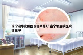 南寧治牛皮癬醫(yī)院哪家最好 南寧銀屑病醫(yī)院哪里好