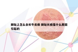 腳趾上怎么會長牛皮癬 腳趾長癬是什么原因引起的