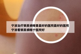 寧波治療銀屑病哪里最好的醫(yī)院最好的醫(yī)院 寧波看銀屑病哪個(gè)醫(yī)院好