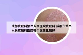 成都皮膚科第二人民醫(yī)院皮膚科 成都市第二人民皮膚科醫(yī)院哪個(gè)醫(yī)生比較好