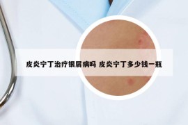 皮炎寧丁治療銀屑病嗎 皮炎寧丁多少錢一瓶