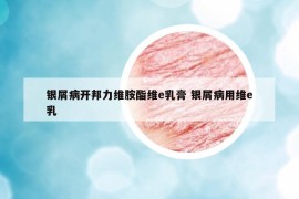 銀屑病開邦力維胺酯維e乳膏 銀屑病用維e乳