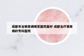 成都市治銀屑病哪家醫(yī)院最好 成都治療銀屑病的?？漆t(yī)院