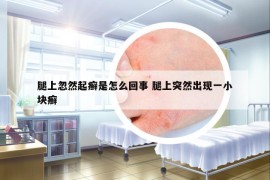 腿上忽然起癬是怎么回事 腿上突然出現(xiàn)一小塊癬