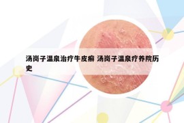 湯崗子溫泉治療牛皮癬 湯崗子溫泉療養(yǎng)院歷史