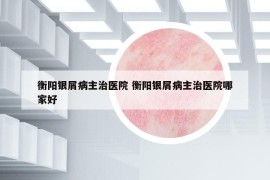 衡陽(yáng)銀屑病主治醫(yī)院 衡陽(yáng)銀屑病主治醫(yī)院哪家好