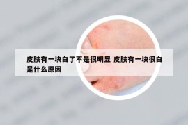 皮膚有一塊白了不是很明顯 皮膚有一塊很白是什么原因