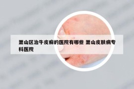 蕭山區(qū)治牛皮癬的醫(yī)院有哪些 蕭山皮膚病?？漆t(yī)院